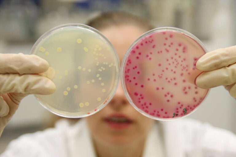 Stem Cells vs. Transplants